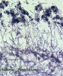 Begroting 🧨 Bresser Preparaten- Voorgeprepareerd - Geschikt Voor Doorzichtmicroscopen - 100 Stuks - Microbiologie & Celbiologie ⌛ -Kamperen-outdoor Verkoopwinkel 550x412 49